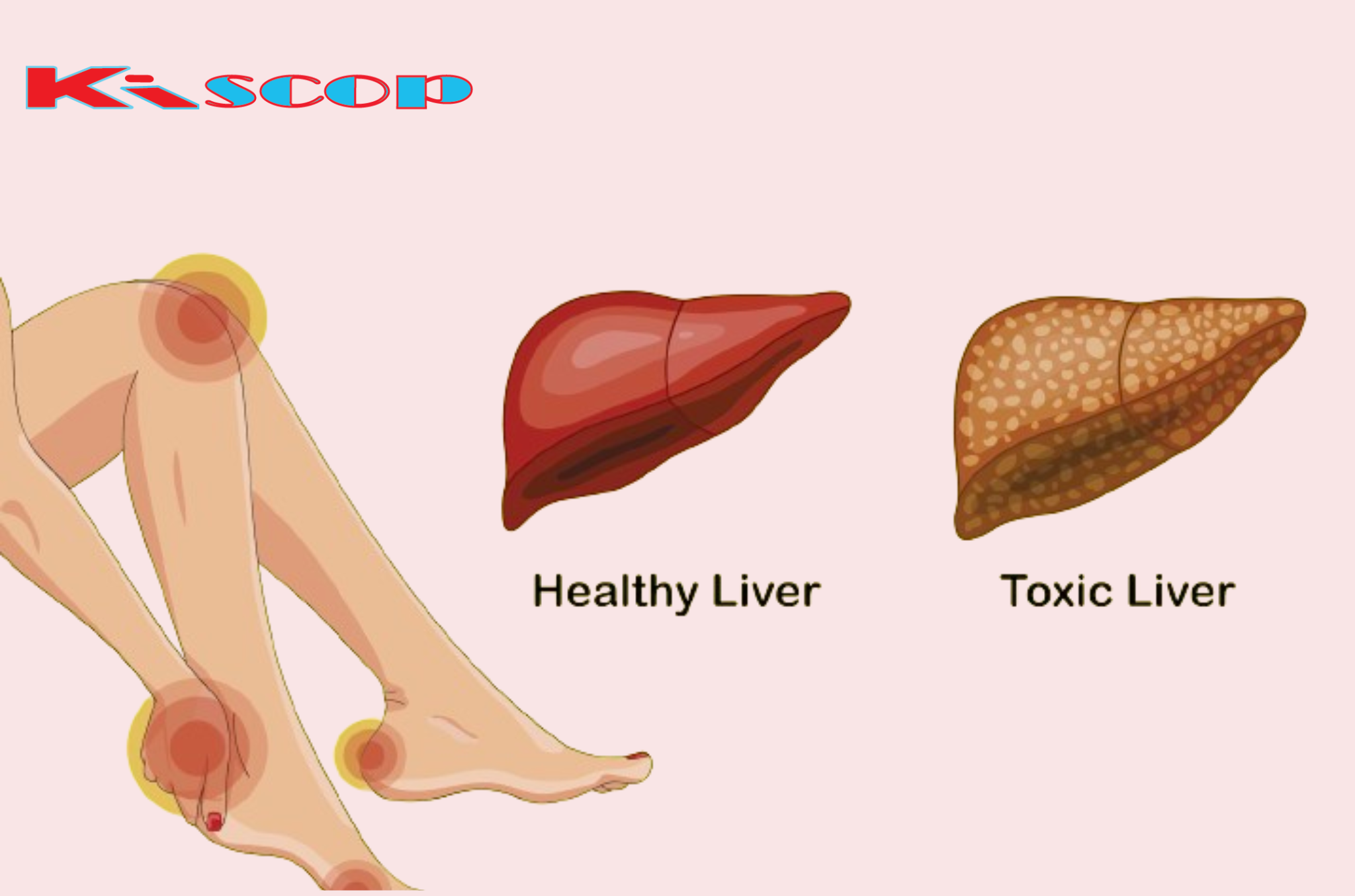 6 Clear Warning Signs Your Liver Is Full of Toxins and Making You Fat (How to Stop It)