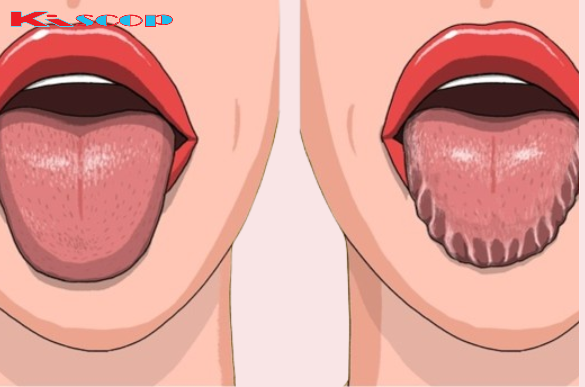 What Your Tongue Indicates About Your Health