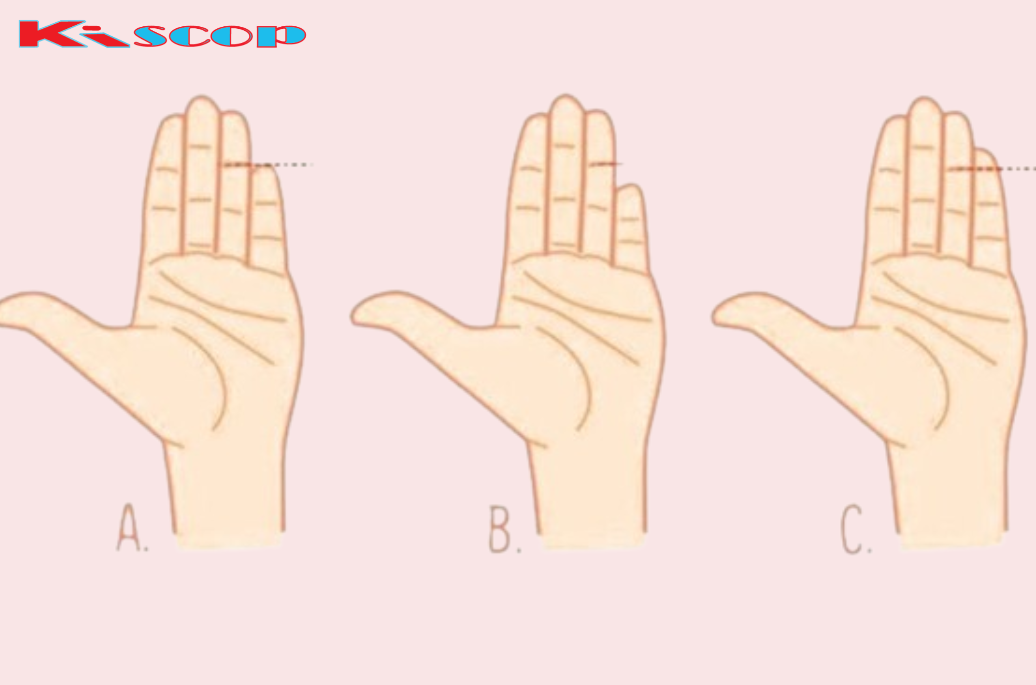 Your Little Finger Can Tell a Lot: What Your Pinky Reveals About Your Health