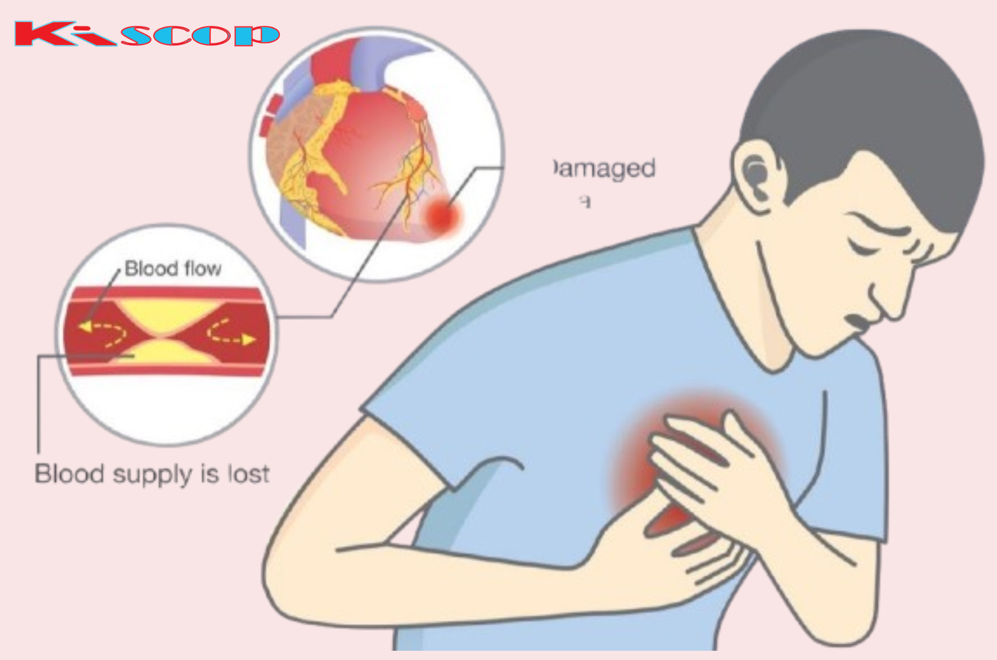 The Most Important Signs of Magnesium Deficiency and What to Do About It