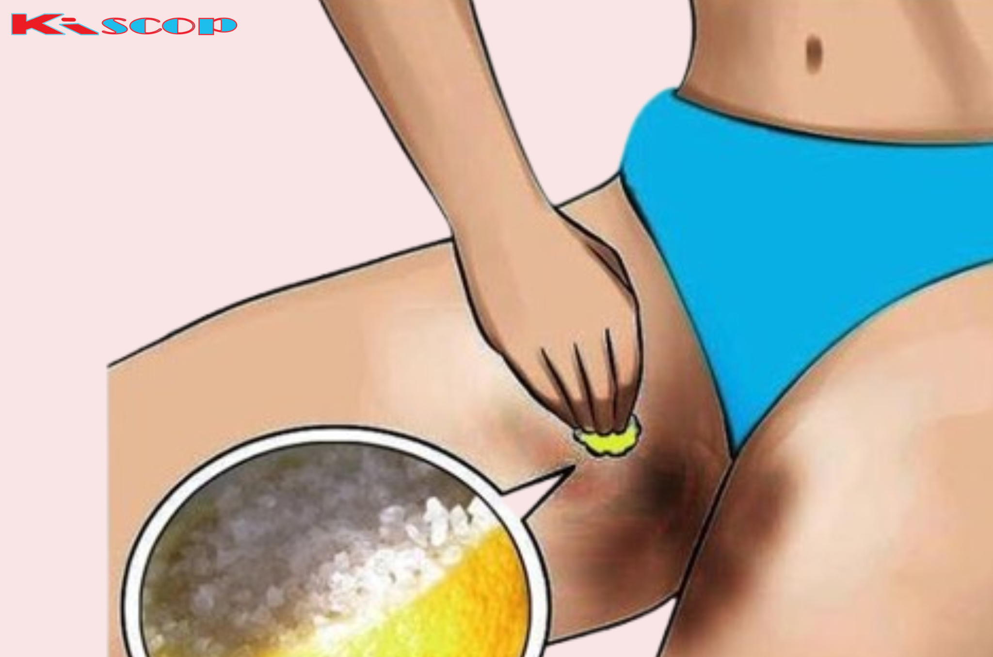 How to Lighten Dark Inner Thighs, Bikini Area, and Butt Naturally